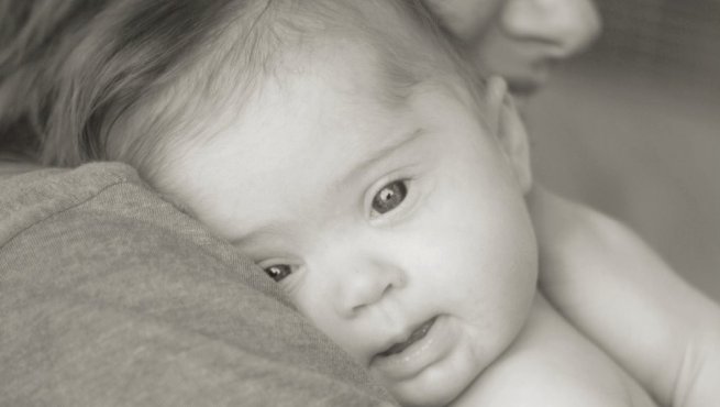 Síndrome de Down | Seu bebê com a gente