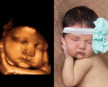 ultrasom do bebê - Pikuruxo